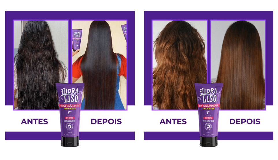 Hidraliso antes e depois (imagem ilustrativa)